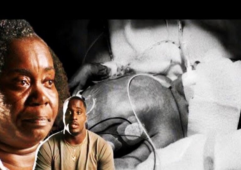 Beating the Odds in Life since Birth: Derick Hall Story